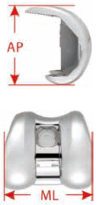 Femoral Component Blueprint and Design