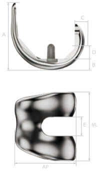 MK CR Femoral Component Blueprint and Photo