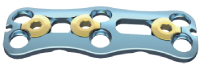 Anterior Cervical Plate I – 6 holes