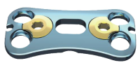Anterior Cervical Plate I – 4 holes