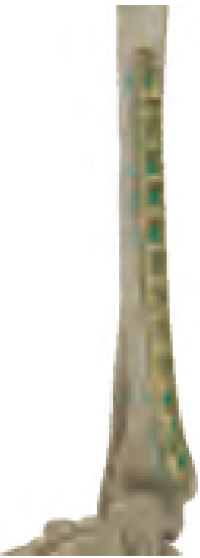 Anatomical Visual Distal Tibia