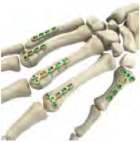 Hand Bone Visual