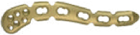 Extension Plate