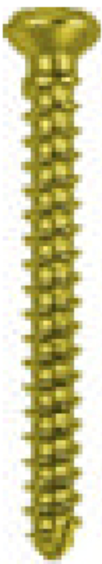1.5mm Cortical Screw