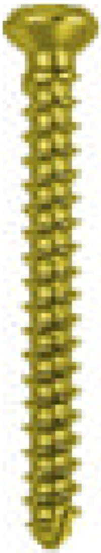 Cortical Gold