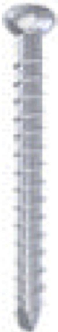 Femoral Nail Locking Screw