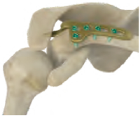 Clavicle bone visual