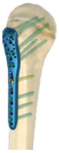 Humerus visual