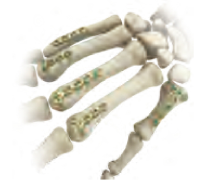 Hand Bone Visual