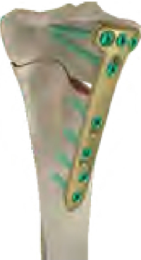 Bone visual P.62