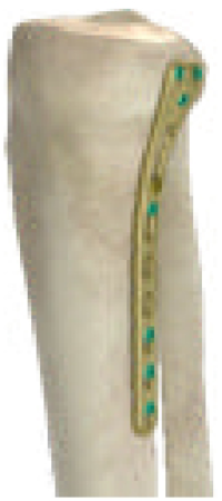 Tibia bone visual
