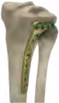 Bone Visual